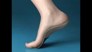 Custom made orthotics for plantar fasciitis [upl. by Nerval]