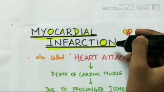 myocardial infarction  pathology  handwritten notes [upl. by Loftus915]