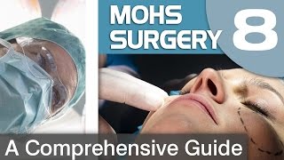 Reconstruction Surgery After Mohs Surgery [upl. by Paterson]