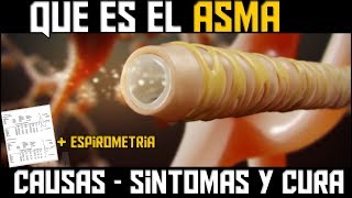 QUE ES EL ASMA ANIMACION  CAUSAS SINTOMAS Y TRATAMIENTO [upl. by Acile]