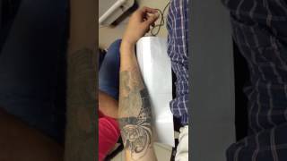 Remoção de tatuagem grande com laser [upl. by Notlef162]