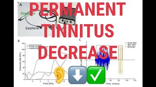 Real Tinnitus Cure Decrease Volume Susan Shores tinnitus device  permanent tinnitus reduction [upl. by Aidyn32]