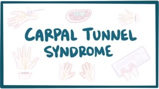 Carpal tunnel syndrome  causes symptoms diagnosis treatment amp pathology [upl. by Tserrof]