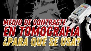 TOMOGRAFIA Y MEDIOS DE CONTRASTE 🤔😰 ☢🩺💡 radiologia TC [upl. by Aisiram]