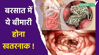 Amoebiasis Disease क्या है  Symptoms Reason और कैसे लें Precautions  Amoebasis Kya Hai Good Life [upl. by Aneeh850]