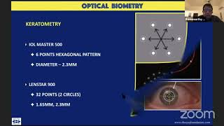 Dr Ramamurthy D  Optical Biometry  Clinical Imaging in Glaucoma amp Cataract AIOS ARC [upl. by Egide]