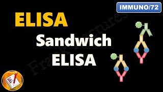 Sandwich ELISA FLImmuno72 [upl. by Nawoj]