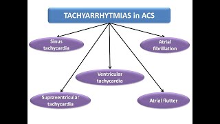 ECG course Tachyarrhythmias with ACS Dr Sherif Altoukhy [upl. by O'Donovan]