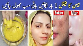 Diy Skin Whitening Facial  Remove Dark Spots Pigmentation  Glass Skin Home Remedies [upl. by Okechuku]