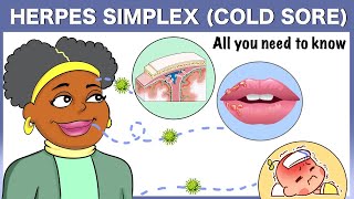 Herpes simplex Cold sore All you need to know [upl. by Hannahc]