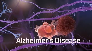 Alzheimers disease Pathophysiology and causes [upl. by Romy]