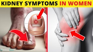 7 Kidney Disease Symptoms in Females [upl. by Elitnahc]