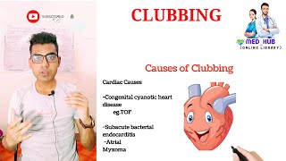 Clubbing Causes  definition waterglass nail carcinoma mbbs clinical medicine  Md Ayub [upl. by Fogel]