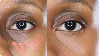 FULLY COVER DARK CIRCLES using Orange color corrector [upl. by Eslud]