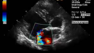 Myxomatous Valvular Degeneration [upl. by Ineslta]