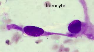 Fibrocyte morphology [upl. by Born]