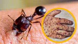 The Most DANGEROUS and SCARY Insects in the World  part 2 [upl. by Acnaiv]