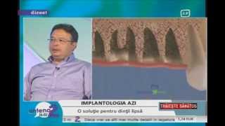 Implantul dentar part1  Dr Chemal Taner [upl. by Nauqed]