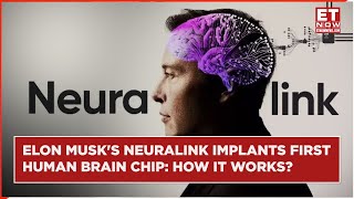 Elon Musks Neuralink Implants Brain Chip In First Human  How It Connects Brain To Computers [upl. by Publias911]