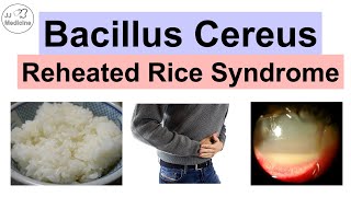 Bacillus Cereus Reheated Rice Syndrome Food Poisoning Pathology Symptoms Diagnosis Treatment [upl. by Bouchier]