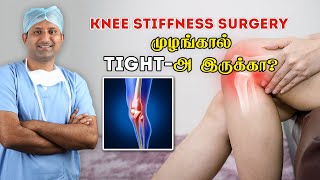 Stiff Knee surgery  முழங்கால் முழுவதும் மடங்க அறுவை சிகிச்சை  Dr Jeya Venkatesh [upl. by Sami481]