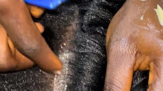 ASMR Greasing scalp Dandruff check and chewing gum Satisfying [upl. by Yovonnda]