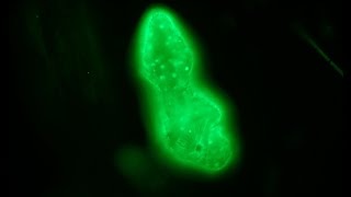 Acridine orange staining for fluorescence  first attempt [upl. by Terrab461]