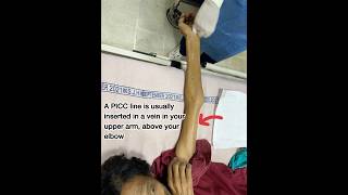 How to insert PICC LINE 📉😱😰in 3mincancercenter cancerpatient cannulation doctor hospital [upl. by Northington558]