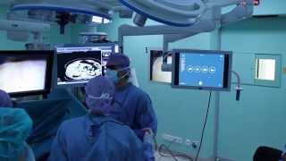 Wearable technology at the OR during laparoscopic surgery using TedCas Myo [upl. by Irby335]