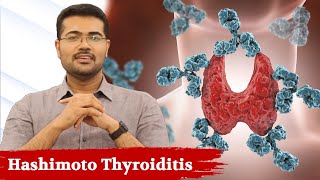 Watch This If You Have Thyroid ProblemHashimoto Thyroiditis  Dr Manoj Johnson [upl. by Av]