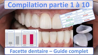 Facette dentaire  Guide complet  Compilation partie 1 à 10 [upl. by Christye]