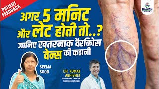 STOP Suffering from Varicose Veins with Critical Treatment [upl. by Convery]