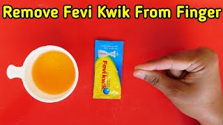 How To Remove Feviquick From Hand Feviquick Remover From Hand [upl. by Ailicec]