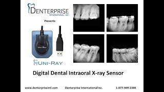 UniRay Digital Dental Xray Sensor Intro [upl. by Jessika]