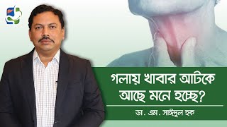 গলায় কিছু আটকে আছে মনে হয় Globus Hystericus Treatment  Causes of Throat Lump Sensation Globus [upl. by Leroj964]