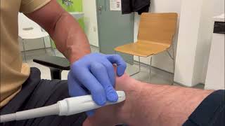 Flexor Hallucis Longus tendon injection by ultrasound guidance [upl. by Nillad]