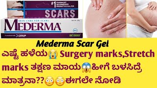 Mederma Scar Gel Review in kannadaUsesside effectssafety Advice surgeryrecovery stretchmarks [upl. by Lindsy]