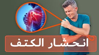 أسباب آلام الكتف انحشار الكتف، التهاب المفصل والتكلس [upl. by Yasnil]