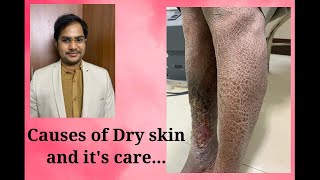 Causes of Dry skin and Tips for dry skin care सूखी त्वचा का कारण क्या है और इसका ख़याल कैसे रखे [upl. by Annyrb]