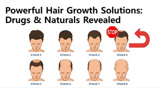 Powerful Hair Growth Solutions Drugs amp Naturals Revealed [upl. by Nadirehs]