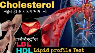 Cholesterol lipid profile testLDLHDL in Hindiby DOCTORLab [upl. by Mufi]