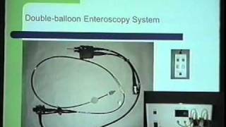 Double Balloon Enteroscopy Dr Jacobs [upl. by Kahcztiy469]