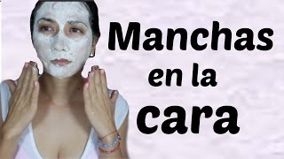 REMEDIO PARA MANCHAS EN LA CARA FACIL [upl. by Nahs291]