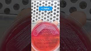 klebsiella in MacConkey Agar। microscope microbiology bacteria youbtube science [upl. by Lovel882]