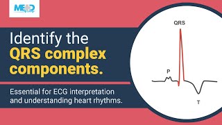 Identifying components of the QRS complex [upl. by Codie]