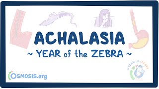 Achalasia Year of the Zebra [upl. by Husha]