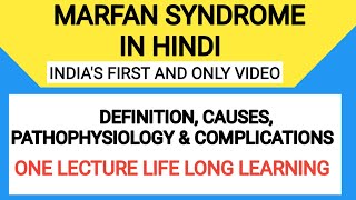 Marfan Syndrome  Marfan Syndrome  causes symptoms diagnosis treatment pathology [upl. by Nylirad]