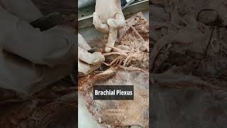 Brachial plexus 1  Anatomy Upper Limb  mbbs neet viral shorts [upl. by Adnam8]