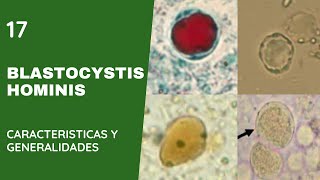 Blastocystis Hominis 17  Blastocistosis  Apicomplexas [upl. by Thorr]