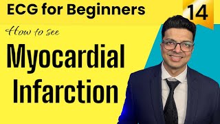 ECG for Beginners  How to see MYOCARDIAL INFARCTION in ECG  जानिए Evolution of MI in ECG [upl. by Kiele]